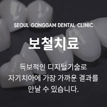 보철치료